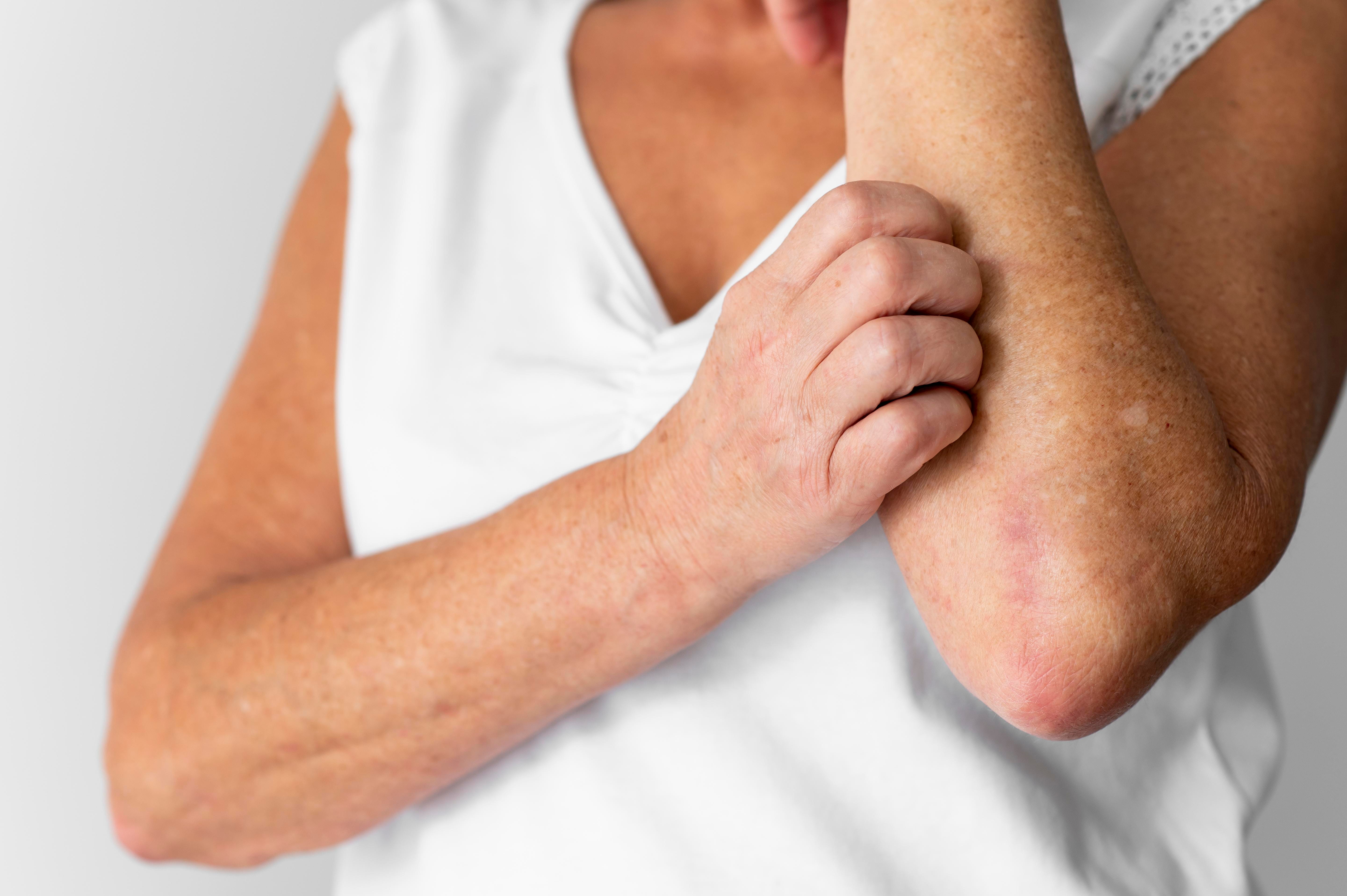 itching skin